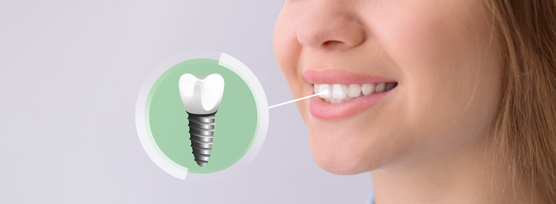 The image shows a woman with a toothpaste tube in her mouth, and there s an illustration of a tooth with a screw symbolizing dental implant technology.