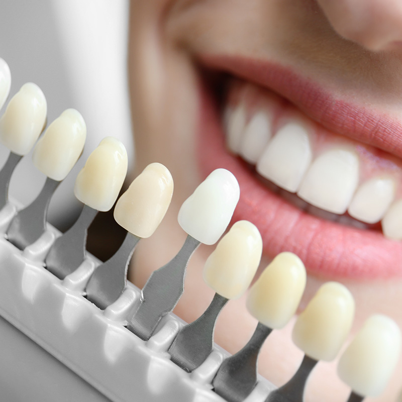 A person smiling at the camera with a dental hygiene device displaying multiple toothbrush heads, each containing white and yellow bristles.