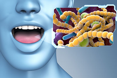 The image shows a person s face with an open mouth, and in the background is a graphic representation of bacteria or microorganisms.