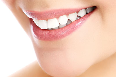 An image of a woman with a radiant smile, showcasing her teeth and lips, set against a white background.