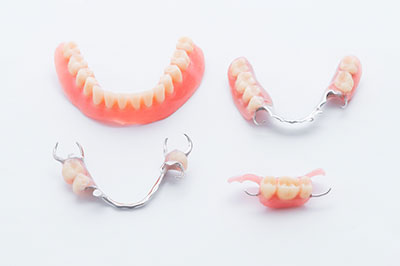 A collection of three dental bridges with a focus on the prosthetic teeth and metal framework, displayed against a white background.