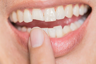 The image shows a person s hand holding a toothbrush close to their mouth, with the focus on the bristles of the toothbrush.