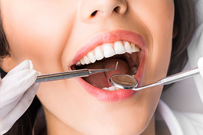 A woman is seated with a large, metallic dental device in her mouth.