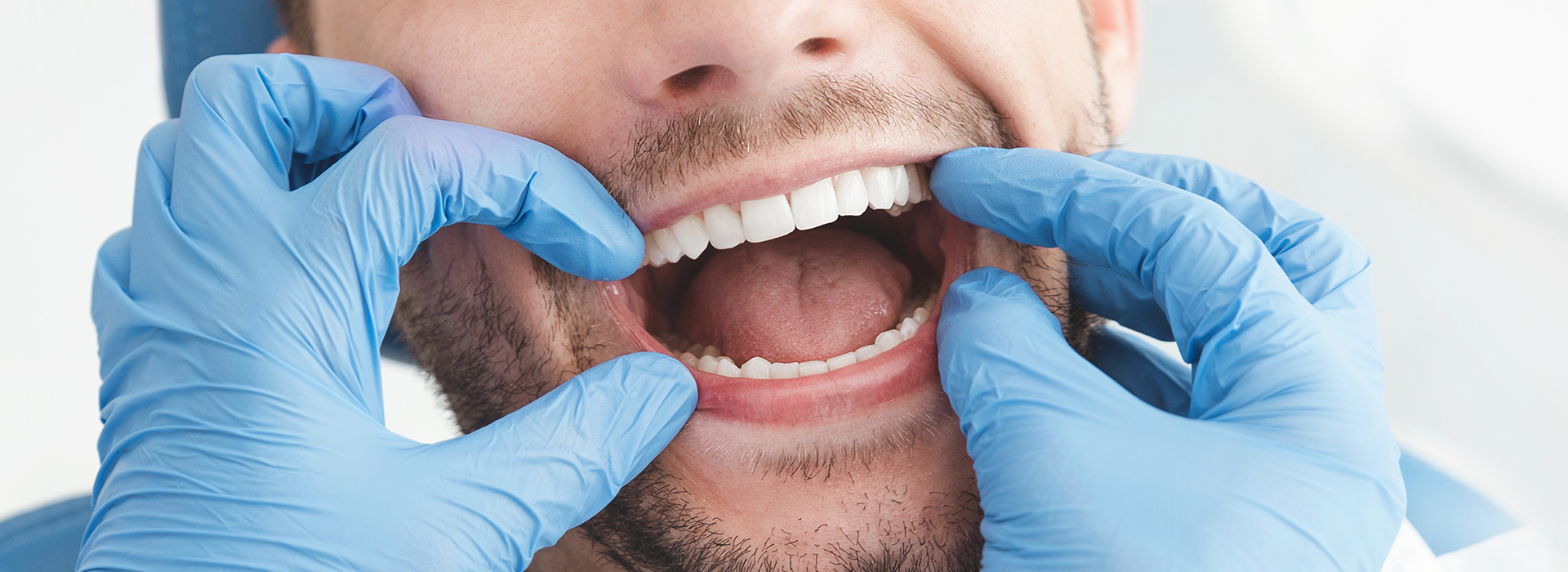 The image shows a man wearing blue gloves and holding his mouth open with one hand, while he appears to be in a dental or medical setting.