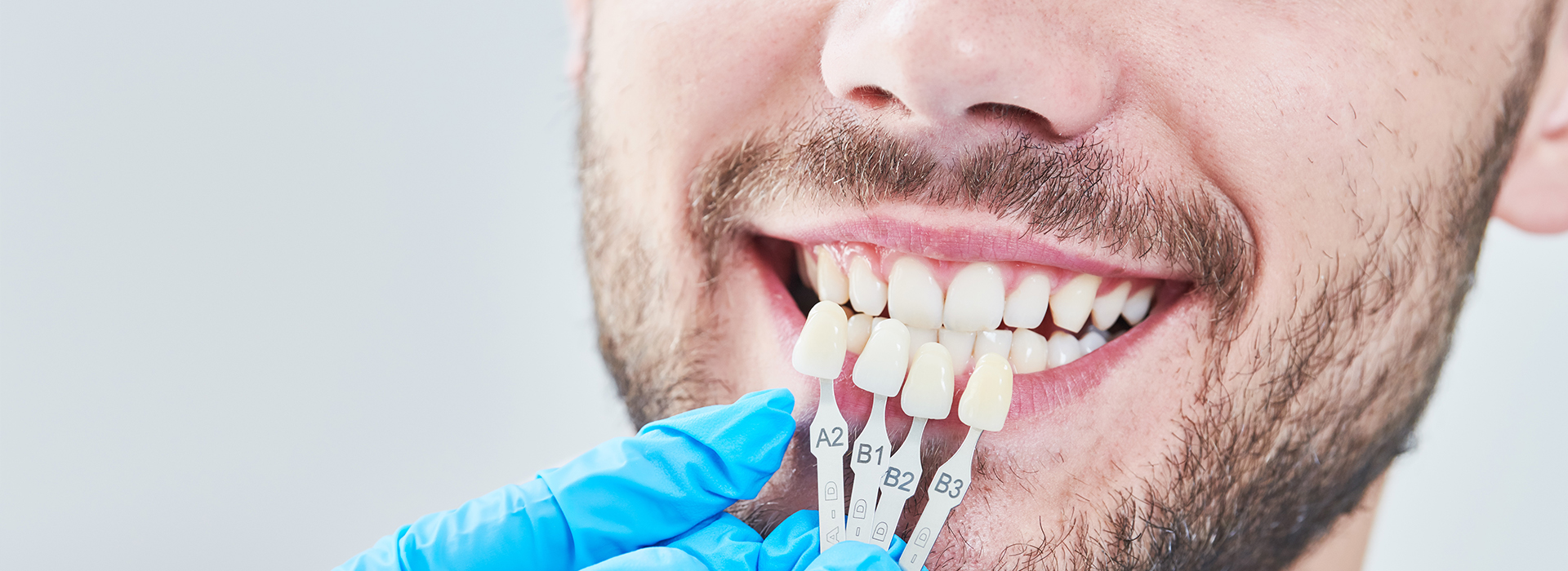 A man with a toothy smile, wearing a blue surgical mask and holding dental implants in his hand.